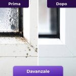 NuroClean image